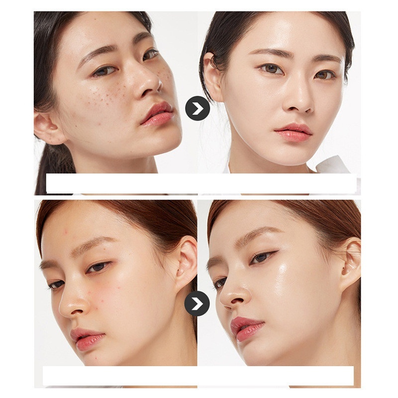Herbal Lightening Acne Cream Skin Care - Image 5