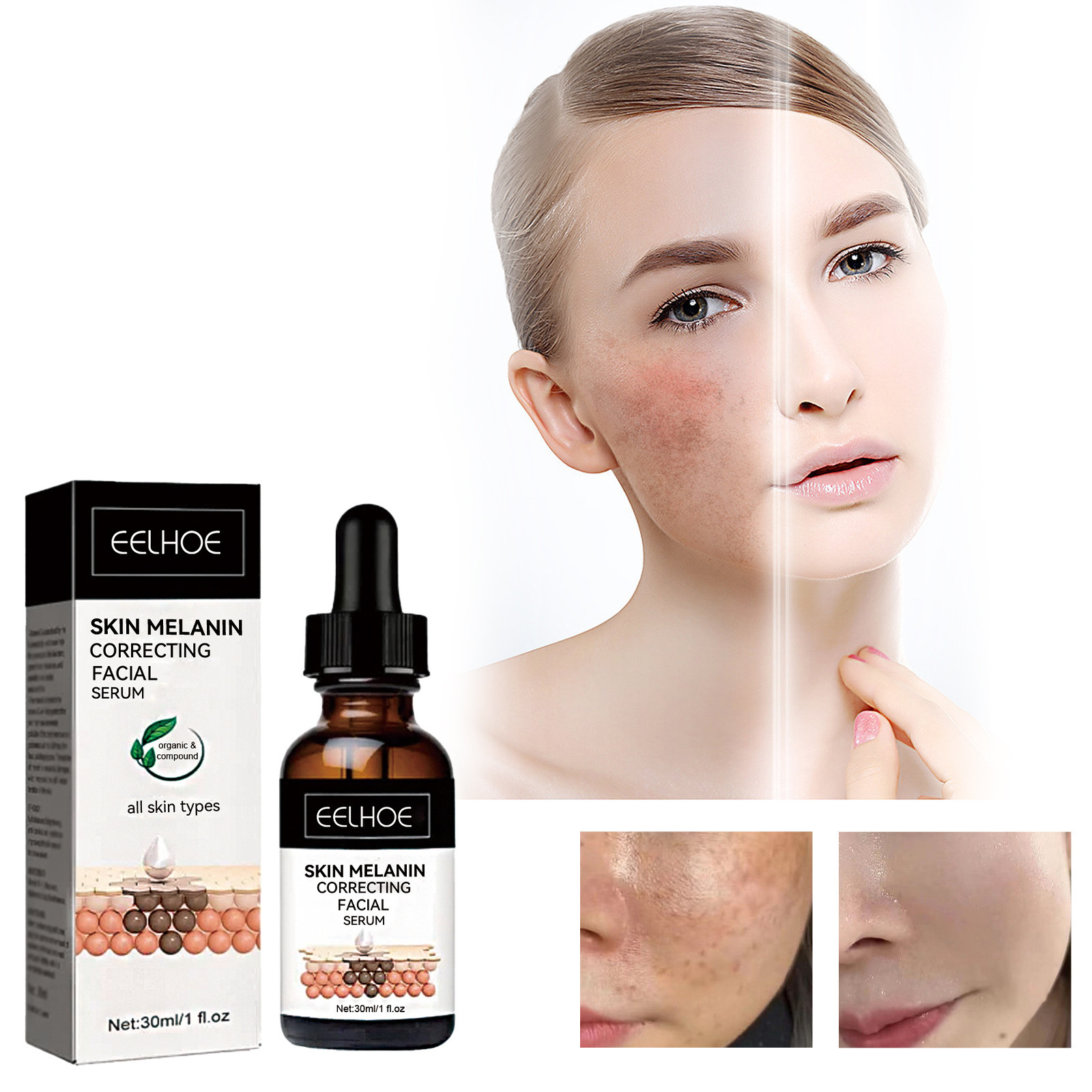 Facial Melanin Repair Hydrating Skincare Products - Image 2