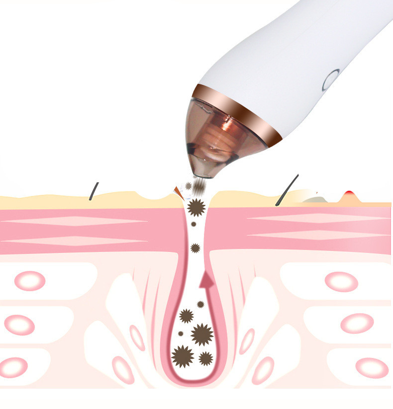 4 in 1 Body Guasha Cupping Blackhead Remover Machine Facial Pore Deep Cleansing Beauty Skin Care - Image 4