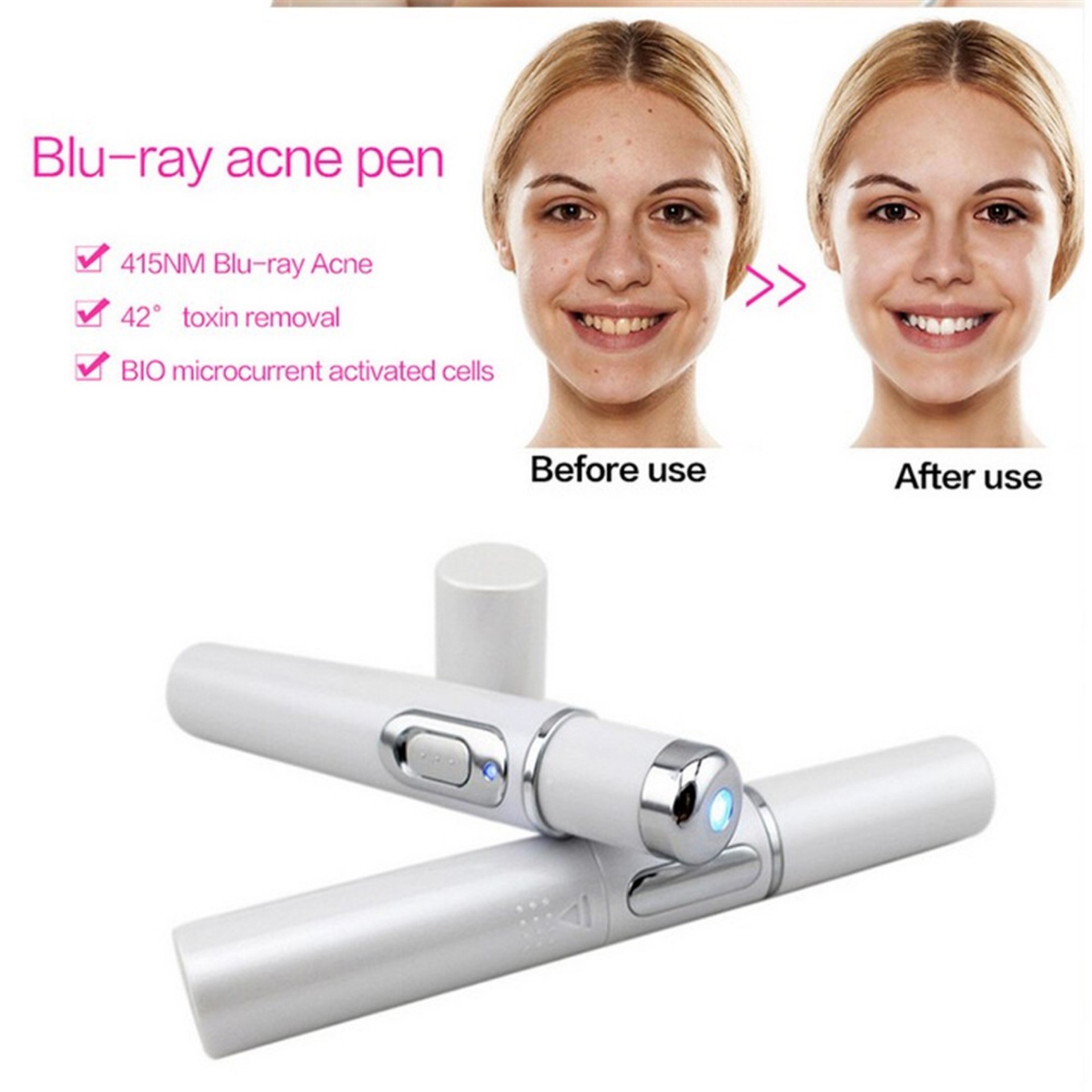 Blue Light Therapy Acne Laser Pen Soft Scar Wrinkle Removal Treatment Device Skin Care Beauty Equipment - Image 9