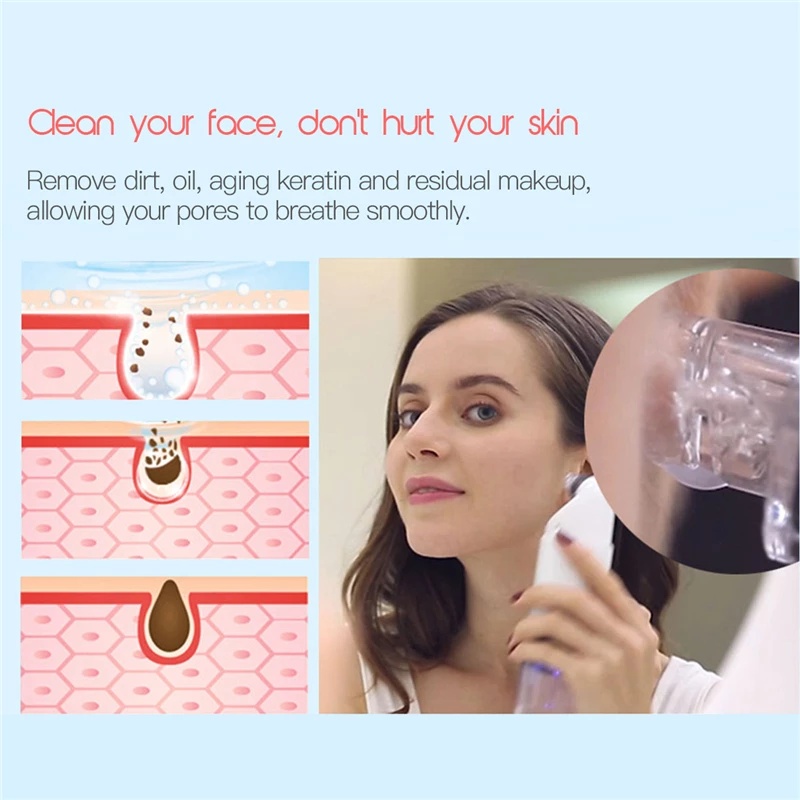 Electric Facial Cleaning Vacuum Cleaner Blackhead Ance Remover Shrink Pores Hydrating Face Skin Care Peeling Device - Image 2