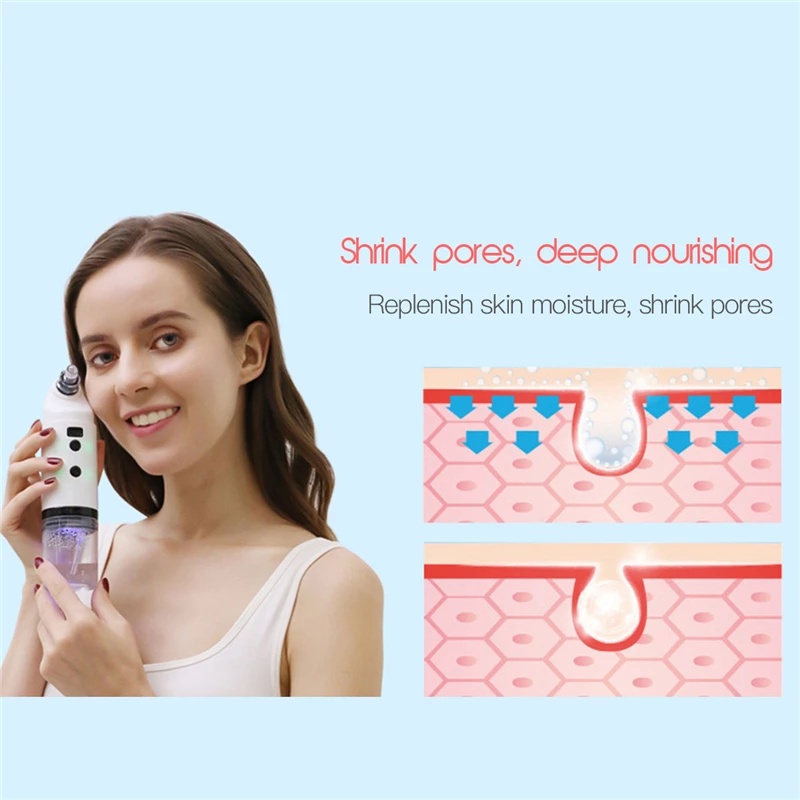 Electric Facial Cleaning Vacuum Cleaner Blackhead Ance Remover Shrink Pores Hydrating Face Skin Care Peeling Device - Image 3