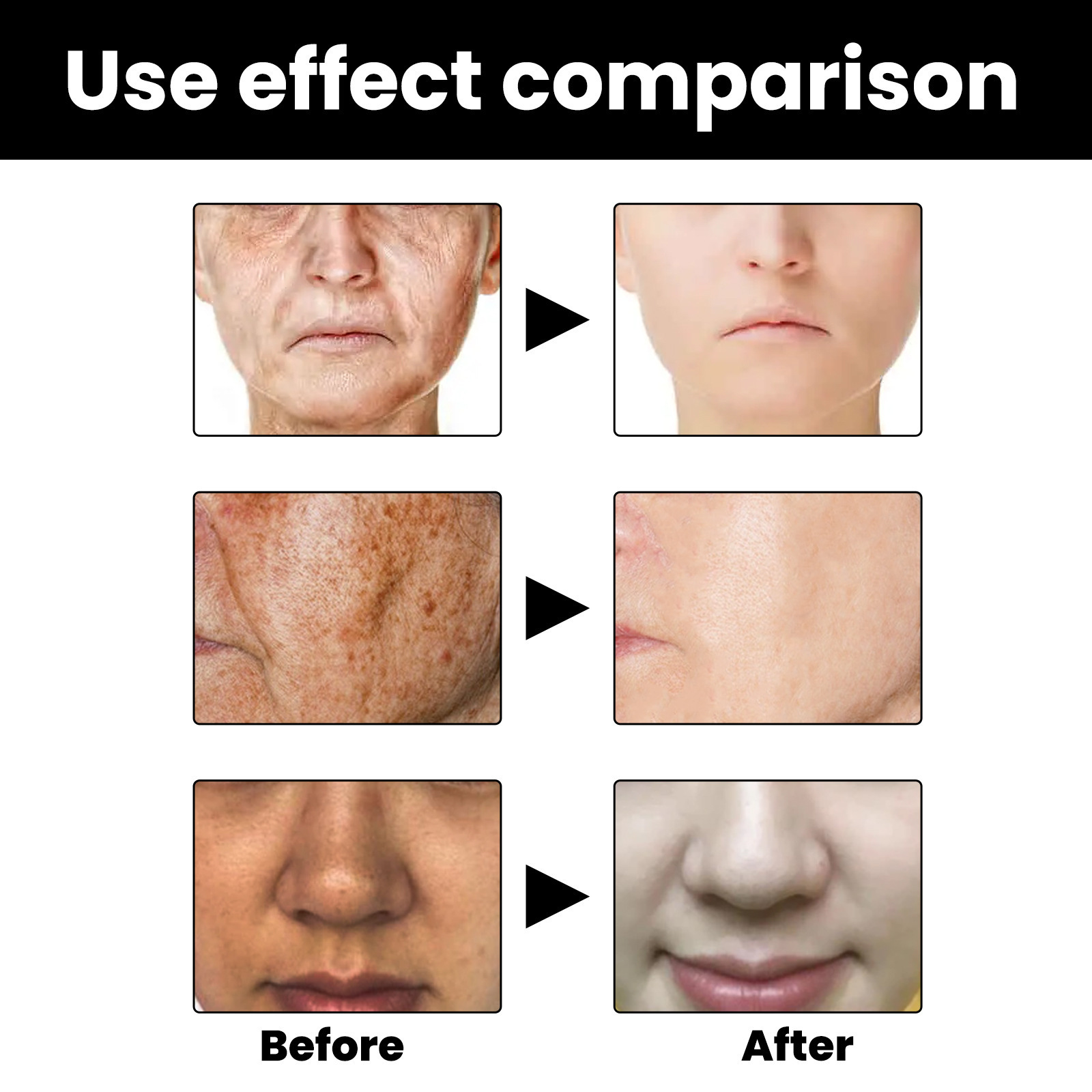 Facial Melanin Repair Hydrating Skincare Products - Image 5