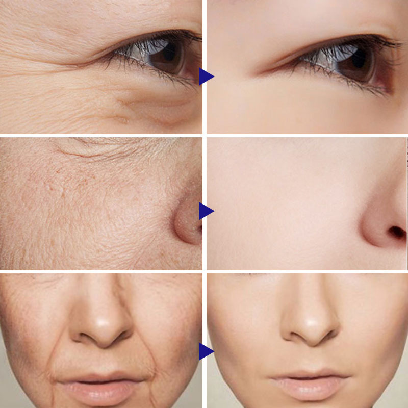 Vitamin C Serum Facial Serum Amazon - Image 3