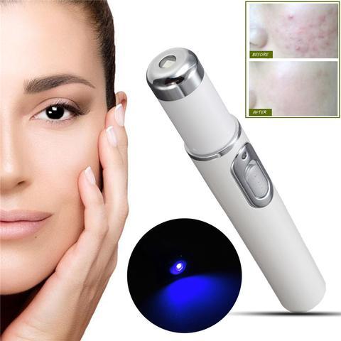 Blue Light Therapy Acne Laser Pen Soft Scar Wrinkle Removal Treatment Device Skin Care Beauty Equipment - Image 2
