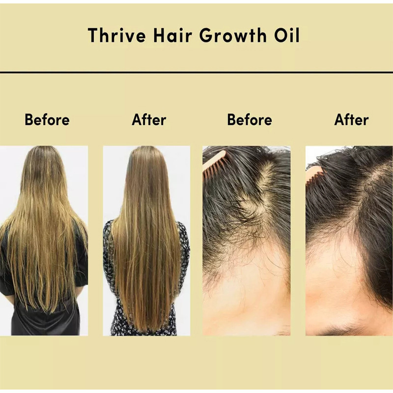 Hair Essential Oil Improve Dryness And Irritability And Nourish - Image 2