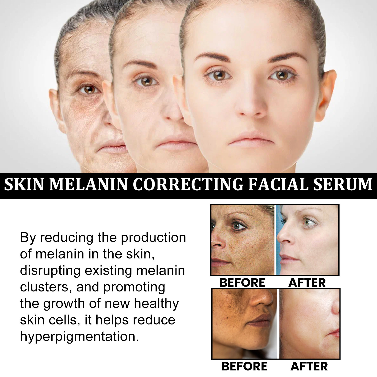 Facial Melanin Repair Hydrating Skincare Products - Image 3