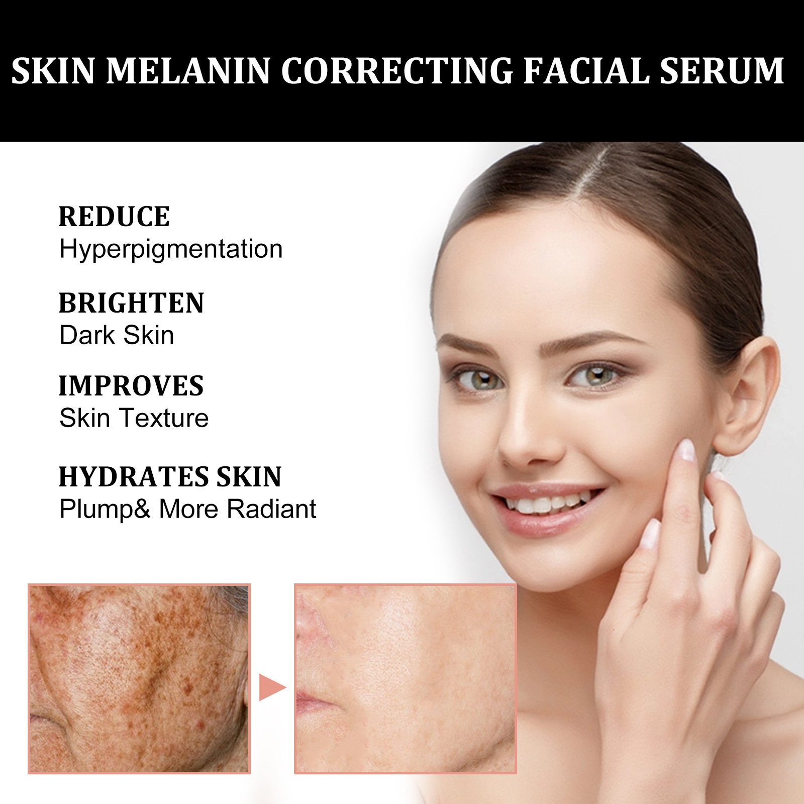 Facial Melanin Repair Hydrating Skincare Products - Image 4