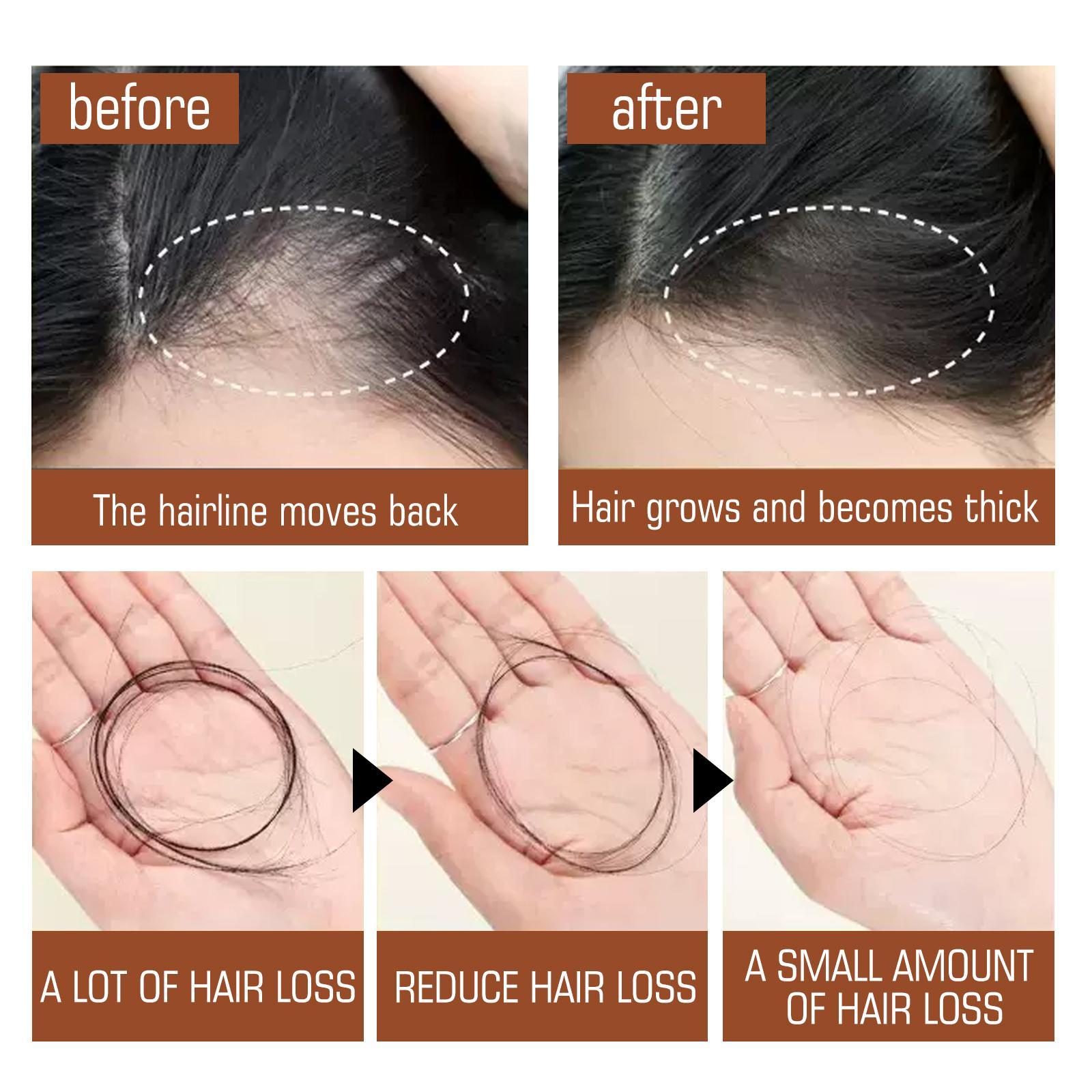 Batana Oil From Honduras - Get Fuller, Thicker, Healthier Hair - Great Gifts For Women Men Conditioner Haircare Silky - Hair Nutrition - Image 2