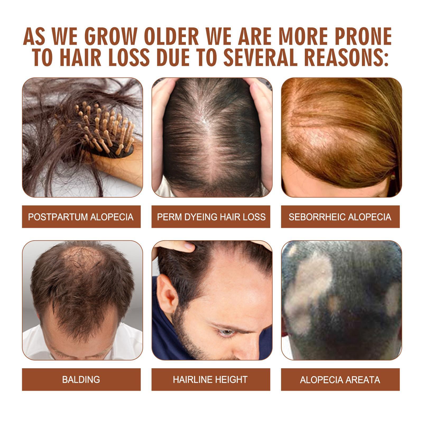 Batana Oil From Honduras - Get Fuller, Thicker, Healthier Hair - Great Gifts For Women Men Conditioner Haircare Silky - Hair Nutrition - Image 8