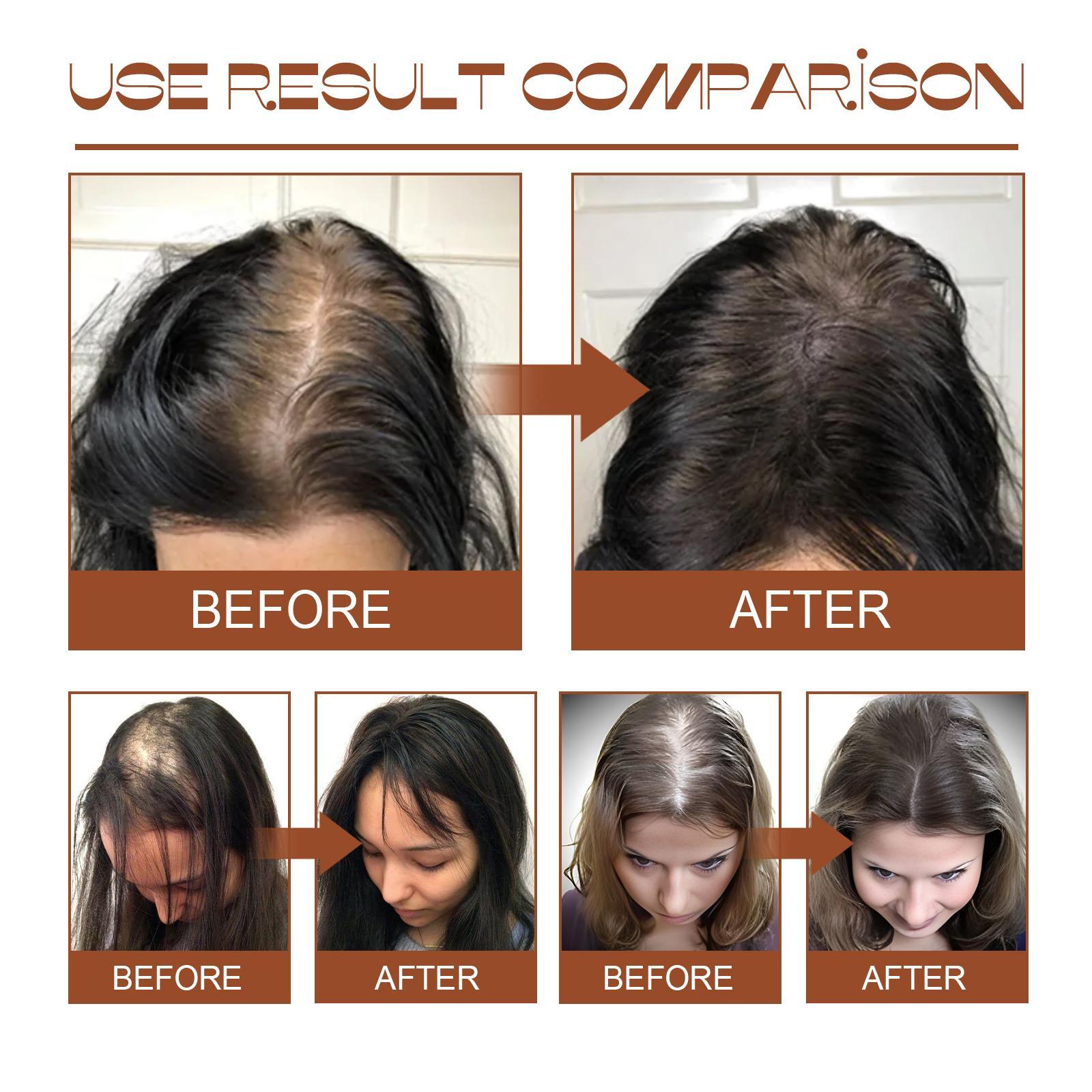 Batana Oil From Honduras - Get Fuller, Thicker, Healthier Hair - Great Gifts For Women Men Conditioner Haircare Silky - Hair Nutrition - Image 3